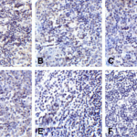 Immunohistochemistry of PD-L2 in human tonsil tissue using (A) RF16021, (B) RF16022, (C) RF16023, (D) RF16024, (E) RF16025, and (F) control mouse IgG antibody at 2 μg/ml.