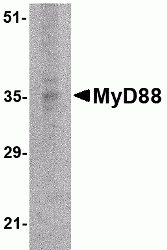 MyD88 Antibody [2E9C2]