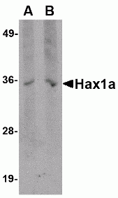 Hax1a Antibody [9F3D11]