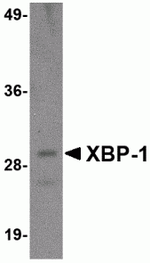 XBP-1 Antibody [3H1G4]