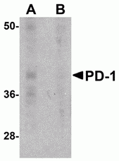 PD-1 Antibody [7A11B1]