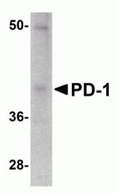 PD-1 Antibody [12A7D7]