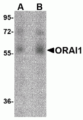 ORAI1 Antibody [3F6H5]
