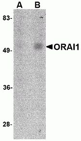 ORAI1 Antibody [6D11A11]