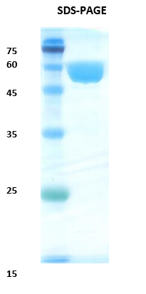 Pathogenic Leptospira lipoprotein LipL32 Recombinant Protein