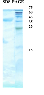 Penicillium notatum allergen Pen n 18 Recombinant Protein