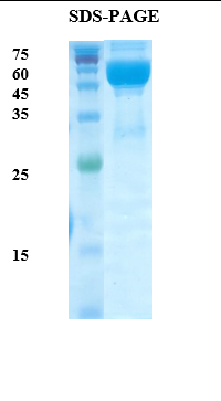 Plasmodium falciparum Lactate Dehydrogenase (Pf-LDH) Recombinant Protein