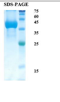 Plasmodium falciparum Merozoite Surface 1 (Pf-MSP-1) Recombinant Protein