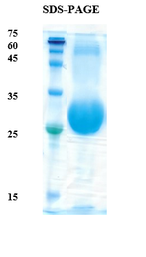 Plasmodium falciparum Merozoite Surface 1 (Pf-MSP-1) Recombinant Protein