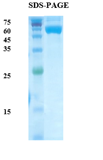 Plasmodium vivax Lactate Dehydrogenase (Pv-LDH) Recombinant Protein