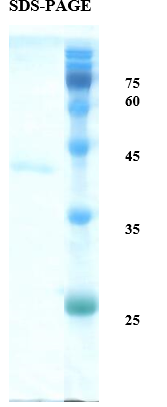 Plasmodium vivax Merozoite Surface 1 (Pv-MSP-1) Recombinant Protein