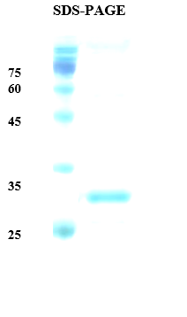 Plasmodium vivax Merozoite Surface 1 (Pv-MSP-1) Recombinant Protein