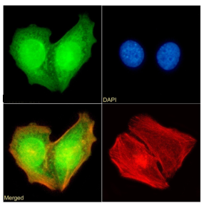 RAD23B Antibody [SAIC-28B-8], Rabbit IgG