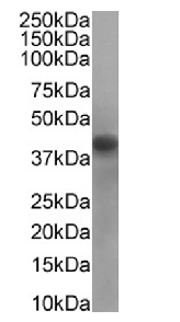 RRM2 Antibody [SAIC-30C-18], Rabbit IgG