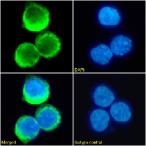 Rhesus D antigen Antibody [D7C2], Rabbit IgG