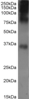 Rhodopsin Antibody [Rho 1D4], Rabbit IgG