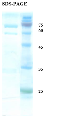 Rubella virus E2 Recombinant Protein
