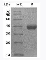 SARS-CoV-2 (COVID-19) S Protein RBD-SD1 Recombinant Protein