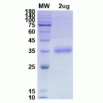 SDS-PAGE Image