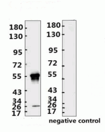 SARS-CoV-2 (COVID-19) Nucleocapsid Monoclonal Antibody [N002]