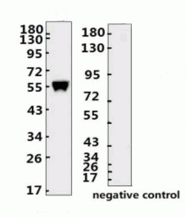 SARS-CoV-2 (COVID-19) Nucleocapsid Monoclonal Antibody [N006]