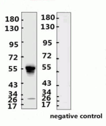 SARS-CoV-2 (COVID-19) Nucleocapsid Monoclonal Antibody [N007]