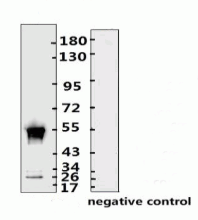 SARS-CoV-2 (COVID-19) Nucleocapsid Monoclonal Antibody [N008]