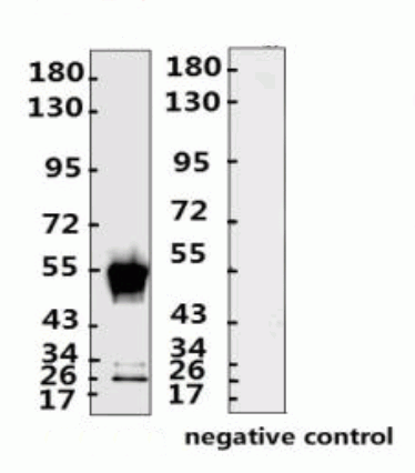 SARS-CoV-2 (COVID-19) Nucleocapsid Monoclonal Antibody [N009]