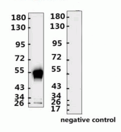 SARS-CoV-2 (COVID-19) Nucleocapsid Monoclonal Antibody [N012]