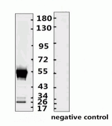 SARS-CoV-2 (COVID-19) Nucleocapsid Monoclonal Antibody [N015]