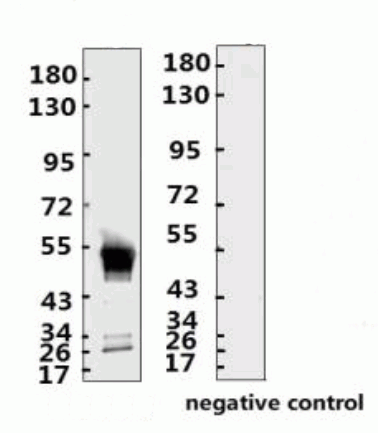 SARS-CoV-2 (COVID-19) Nucleocapsid Monoclonal Antibody [N016]