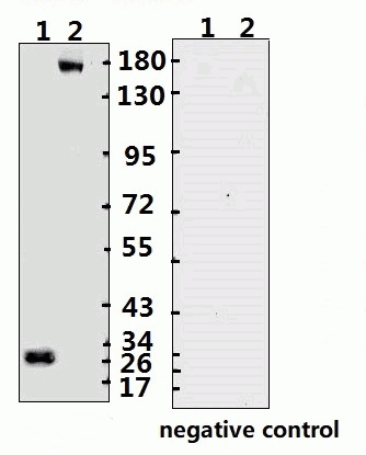 SARS-CoV-2 (COVID-19) Spike ECD Monoclonal Antibody [B004]