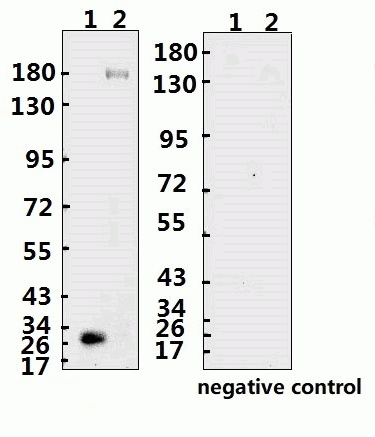 SARS-CoV-2 (COVID-19) Spike ECD Monoclonal Antibody [B005]