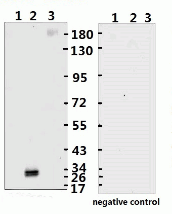 SARS-CoV-2 (COVID-19) Spike RBD Monoclonal Antibody [B002]