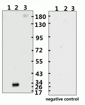 SARS-CoV-2 (COVID-19) Spike RBD Monoclonal Antibody [B002] (HRP)
