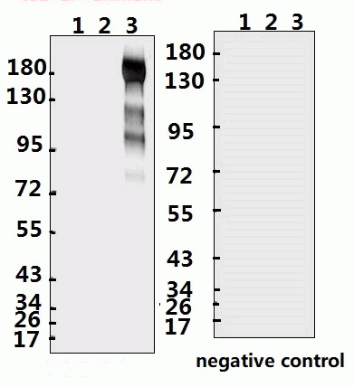 SARS-CoV-2 (COVID-19) Spike S1 Antibody (IN)