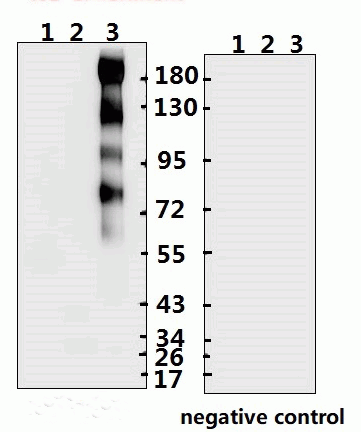 SARS-CoV-2 (COVID-19) Spike S2 Antibody (IN)