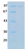 SARS Coronavirus Nucleocapsid  (HSZ-Cc) Recombinant Protein