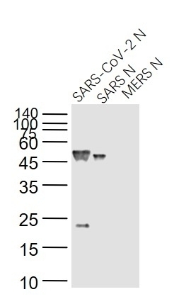 SARS Nucleocapsid Antibody [14B3D]