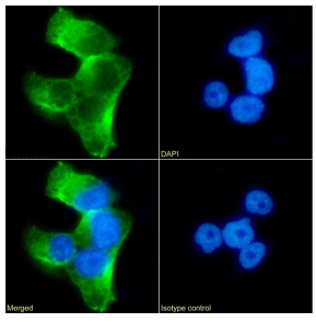 SERPINA6 Antibody [SAIC-42B-10], Rabbit IgG