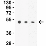 <strong>WB Validation in Human</strong>Loading: 10 μg of lysate per lane.Antibodies: Steap1 4303, 2 μg/mL, 1 h incubation at RT in 5% NFDM/TBST. Secondary: Goat anti-rabbit IgG HRP conjugate at 1:10000 dilution.