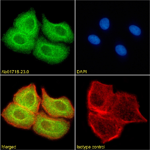 SUV420H2 Antibody [RAB-C409], Rabbit IgG