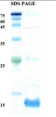 Salmon fish allergen Sal s 1 Recombinant Protein