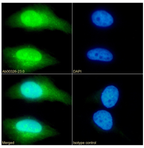 TAGLN Antibody [SAIC-33B-129], Rabbit IgG