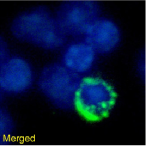 TCR Antibody [Desire-1], Rabbit IgG