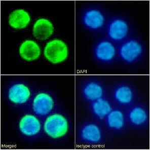 TIM-2 Antibody [RMT2-14], Rabbit IgG