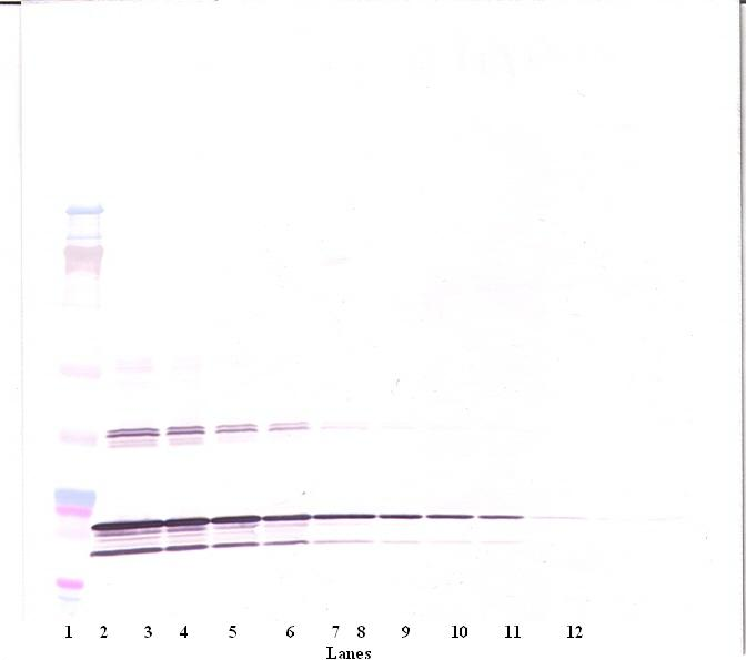 TNF-beta Antibody