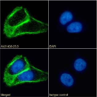 Tetraspanin 1 Antibody [4/12], Rabbit IgG