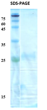 Toxoplasma gondii Surface Antigen (SAG) 2 Recombinant Protein
