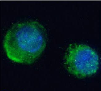 Transferrin Antibody [TW4.20], Rabbit IgG